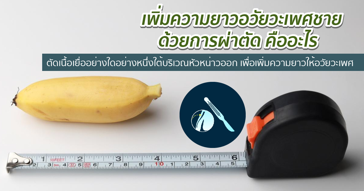 ผ่าตัดเพิ่มความยาว