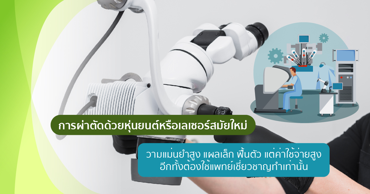 ผ่าตัดด้วยหุ่นยนต์