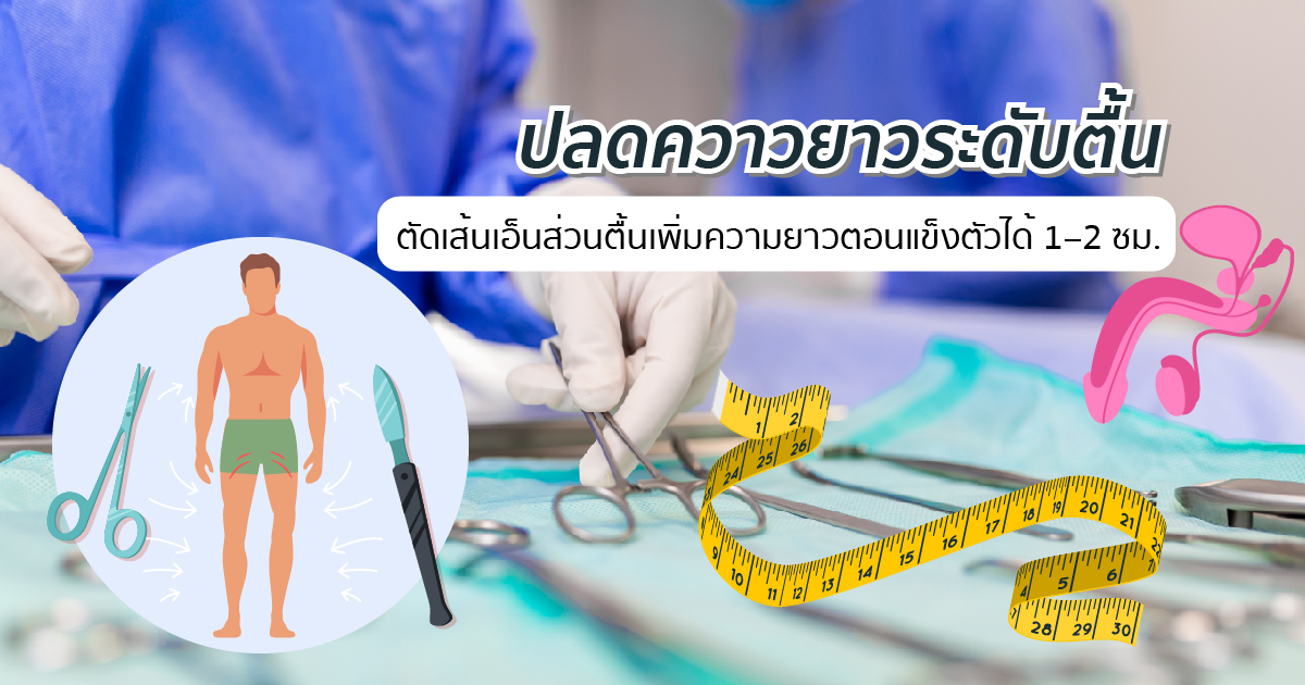 ปลดความยาวระดับตื้น