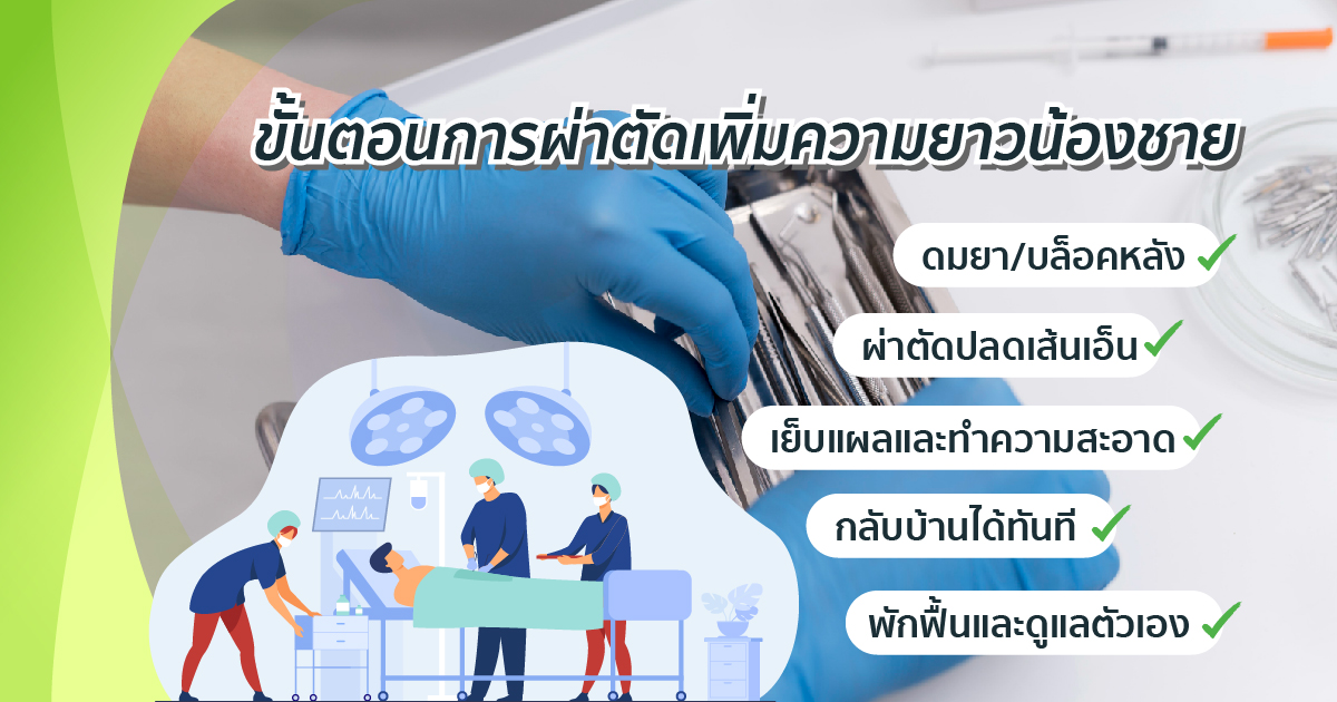 ขั้นจอนผ่าตัด